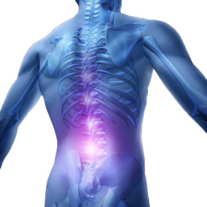 Muscle spasms and tension cause severe pain